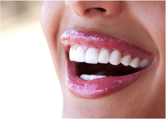 Dental Implants Pictures