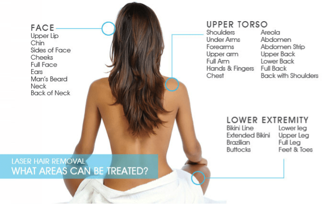 laser-hair-removal-areas