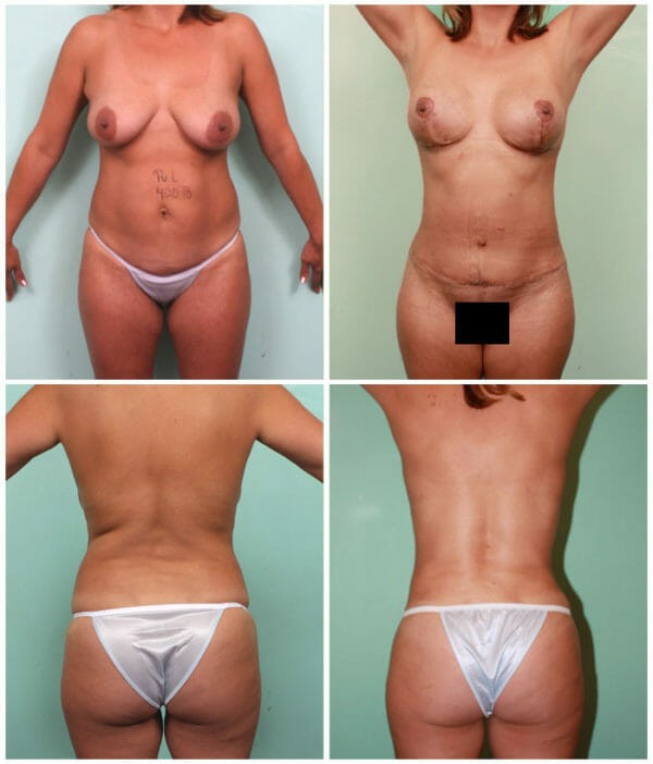 Trussler Plastic Surgery For Body