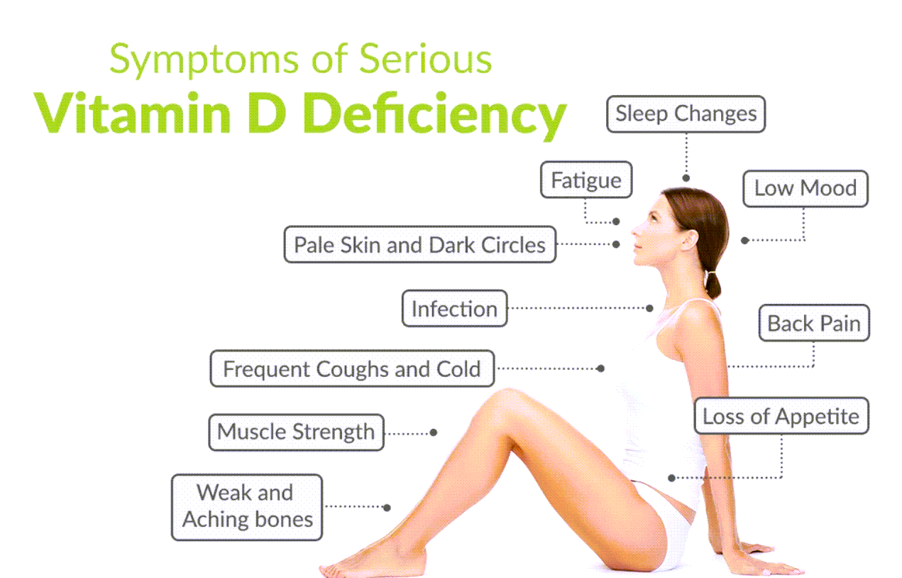 Vitamin deficiency. Vitamin d deficiency. Vitamin d deficiency Symptoms. Causes of Vitamin d deficiency.