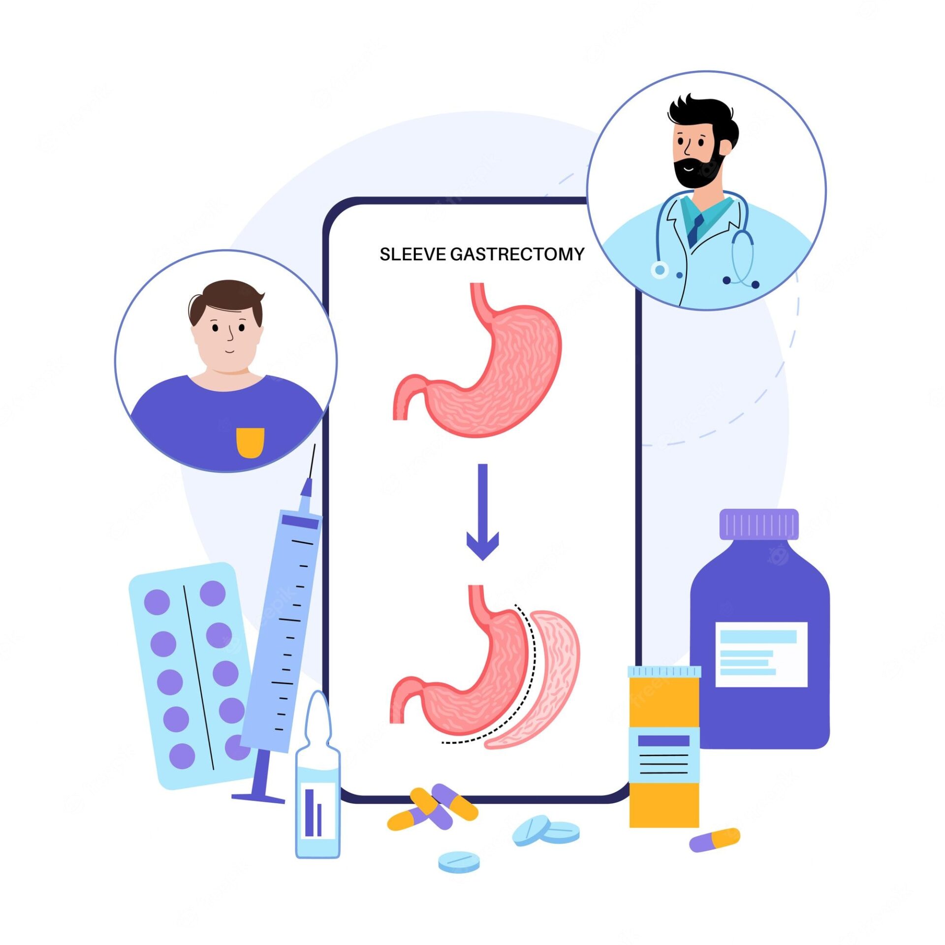 Is Revision surgery after Gastric Bypass possible?