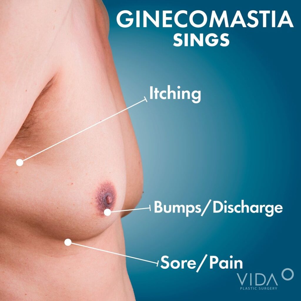 Types of Gynecomastia: Does Gynecomastia Come in Different Forms