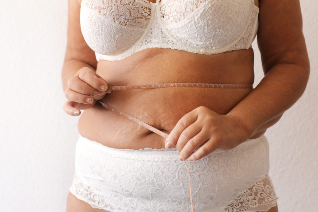 Mujer con sobrepeso midiendo su abdomen.